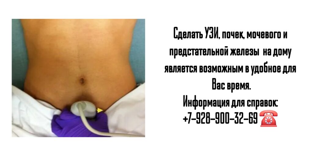 Узи мочевого пузыря и предстательной железы на дому в Ростове-на-Дону