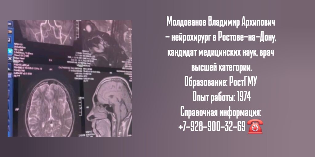 Консультация опытного нейрохирурга - Молдованов Владимир Архипович 