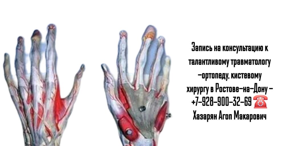 Кистевой хирург Хазарян Агоп Макарович