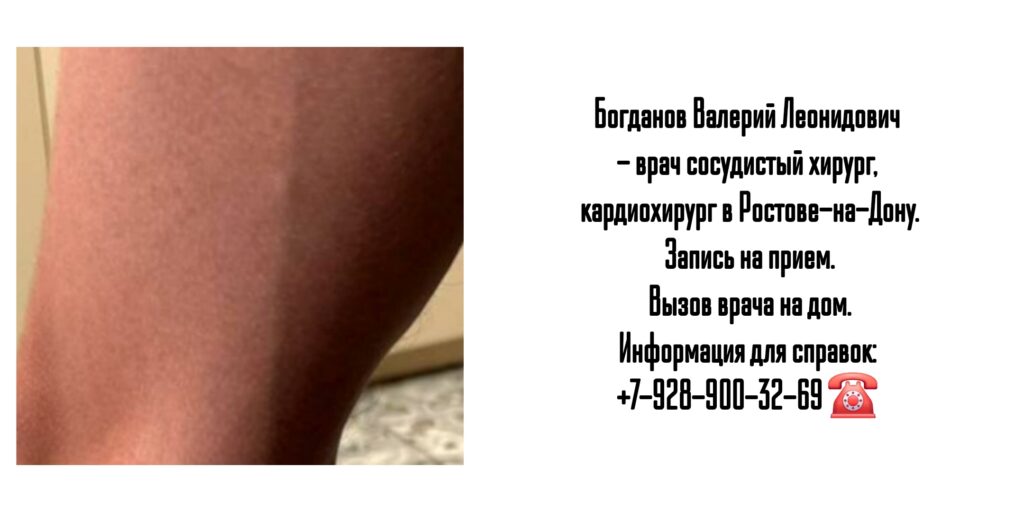 Сосудистый хирург Ростов - Богданов Валерий Леонидович