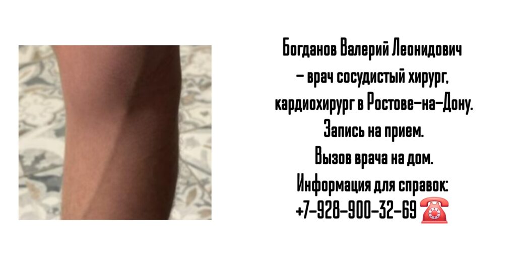 Сосудистый хирург Ростов - Богданов Валерий Леонидович