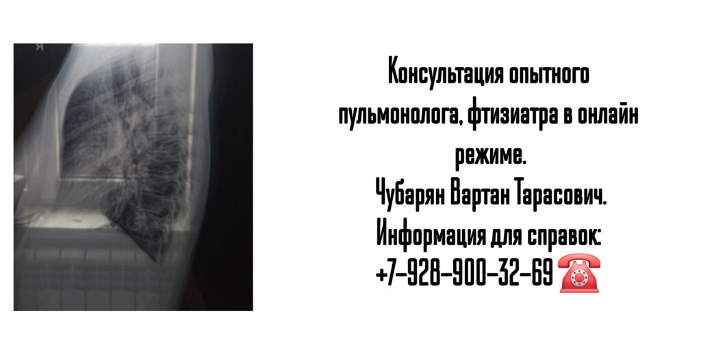Вартан Тарасович Чубарян - консультация пульмонолога в телефонном режиме