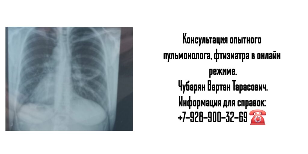 Вартан Тарасович Чубарян - консультация пульмонолога в телефонном режиме