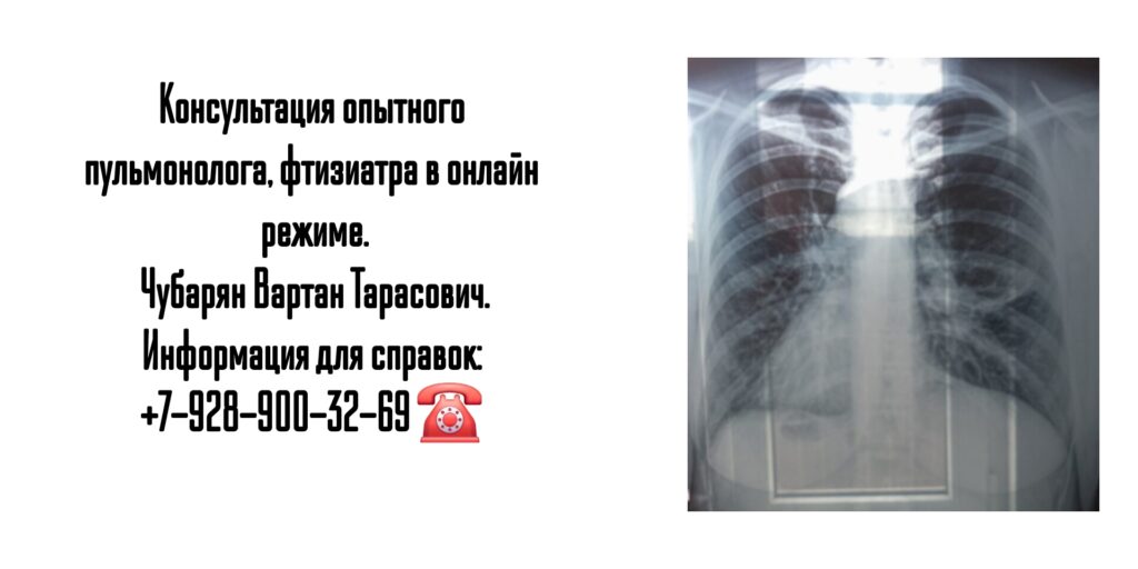 Вартан Тарасович Чубарян - консультация пульмонолога в телефонном режиме