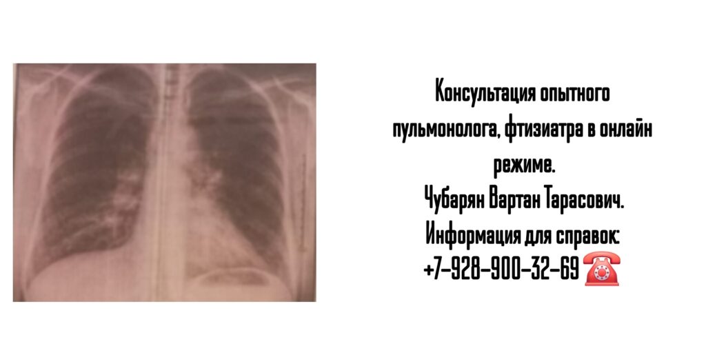 Вартан Тарасович Чубарян - консультация пульмонолога в телефонном режиме