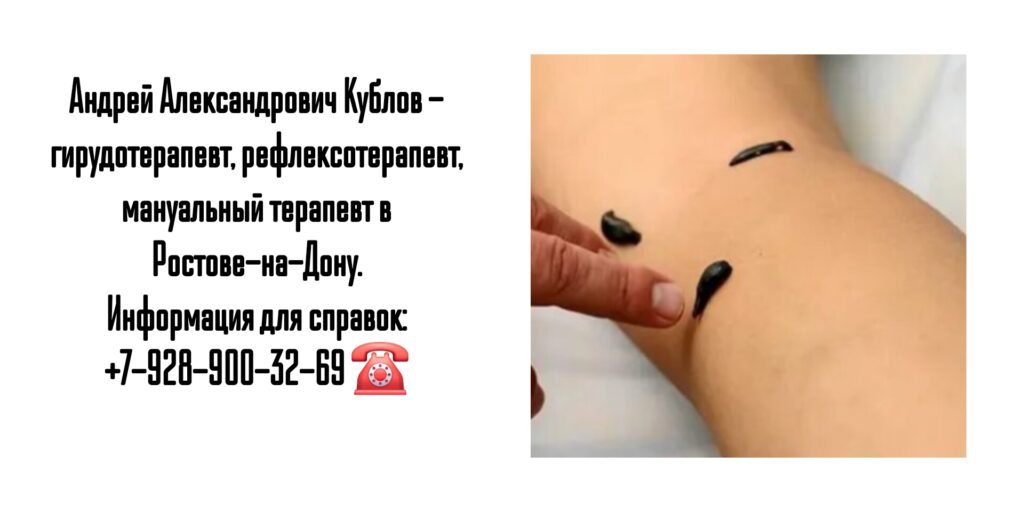 Андрей Александрович Кублов - гирудотерапия Ростов 
