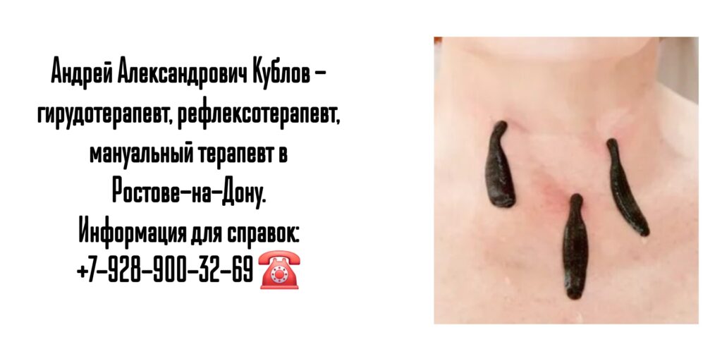 Андрей Александрович Кублов - гирудотерапия Ростов 