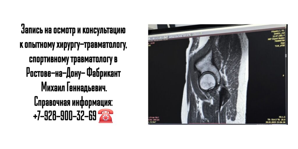 Фабрикант Михаил Геннадьевич- Ведущие хирург-травматолог в Ростове-на-Дону и РО