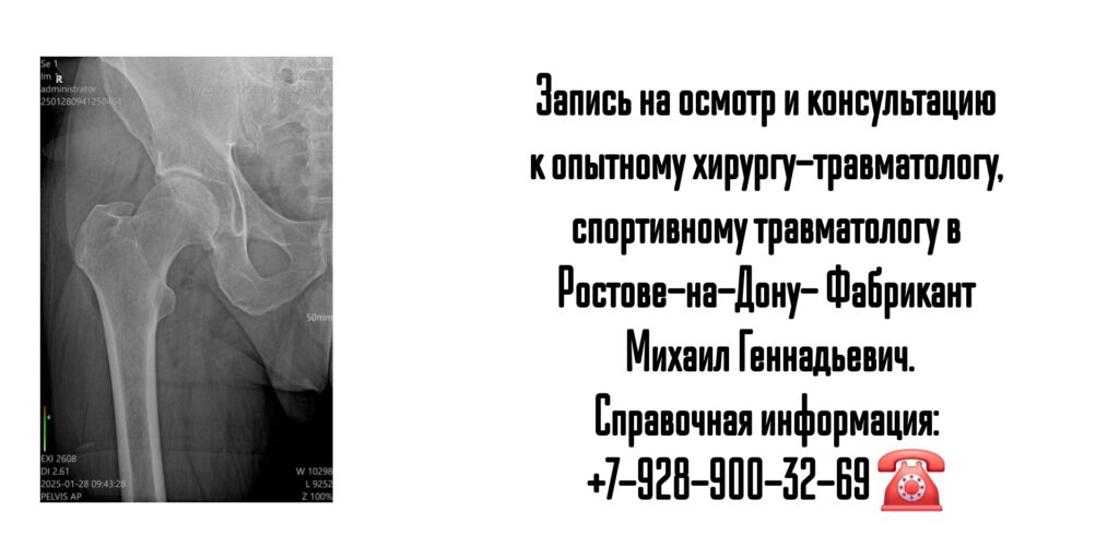 Фабрикант Михаил Геннадьевич- Ведущие хирург-травматолог в Ростове-на-Дону и РО