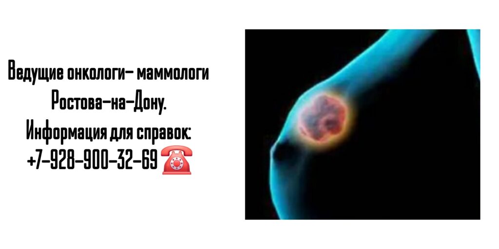 Дмитренко Алексей Петрович - онколог-маммолог Ростов-на-Дону