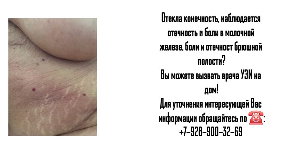Ростов-на-Дону - УЗИ на дом