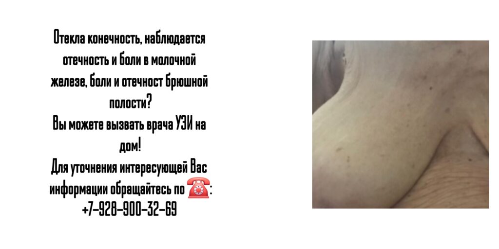 Ростов-на-Дону - УЗИ на дом