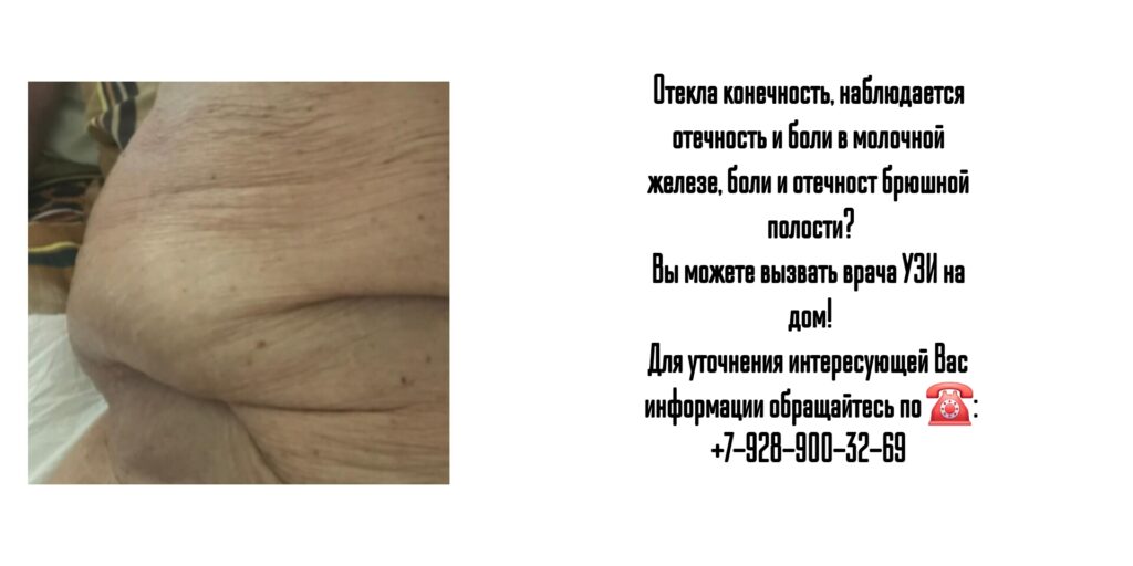 Ростов-на-Дону - УЗИ на дом