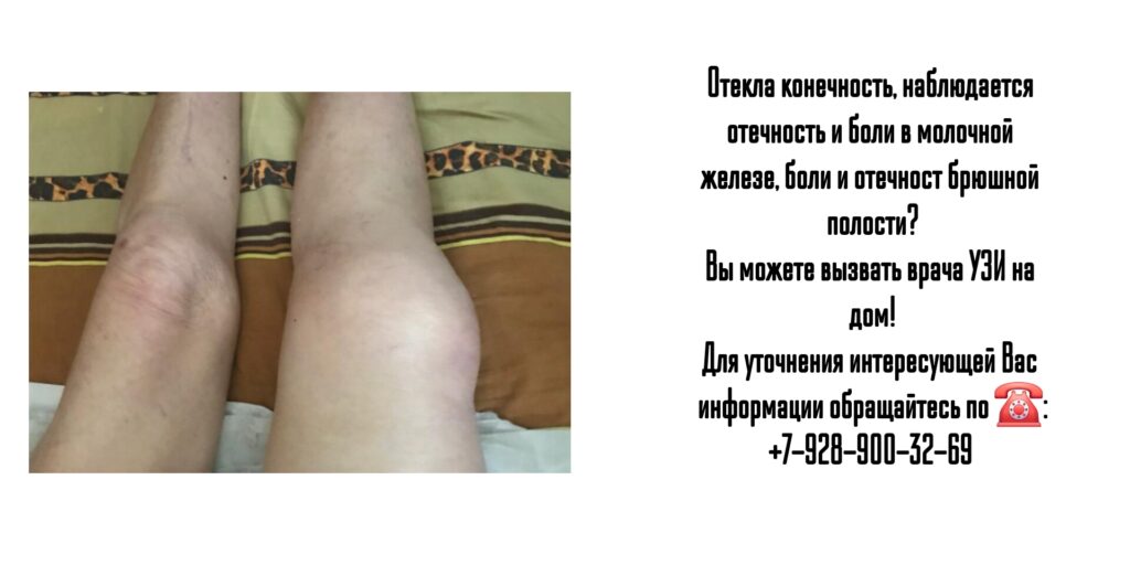 Ростов-на-Дону - УЗИ на дом
