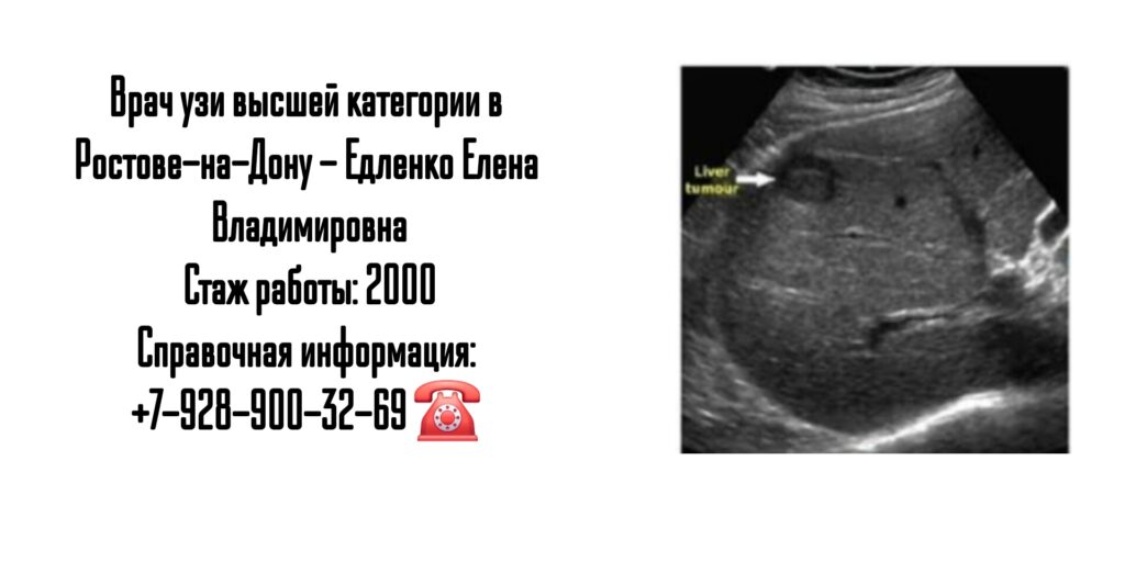 Елена Владимировна Едленко - врач УЗИ в Ростове-на-Дону