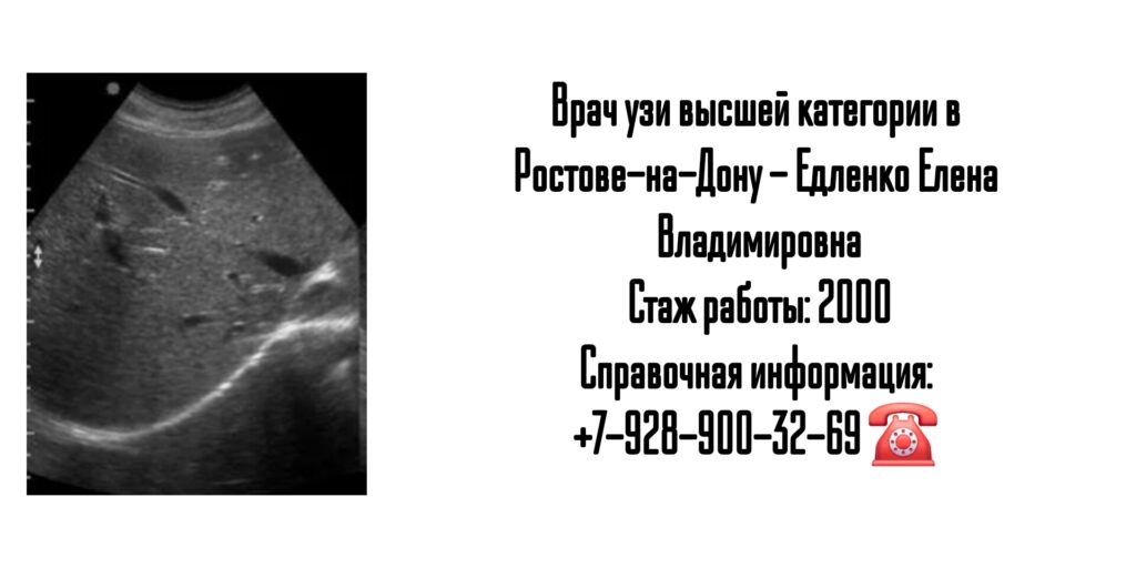 Елена Владимировна Едленко - врач УЗИ в Ростове-на-Дону