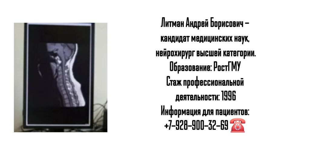 Литман Андрей Борисович- опытный нейрохирург в Ростове-на-Дону 