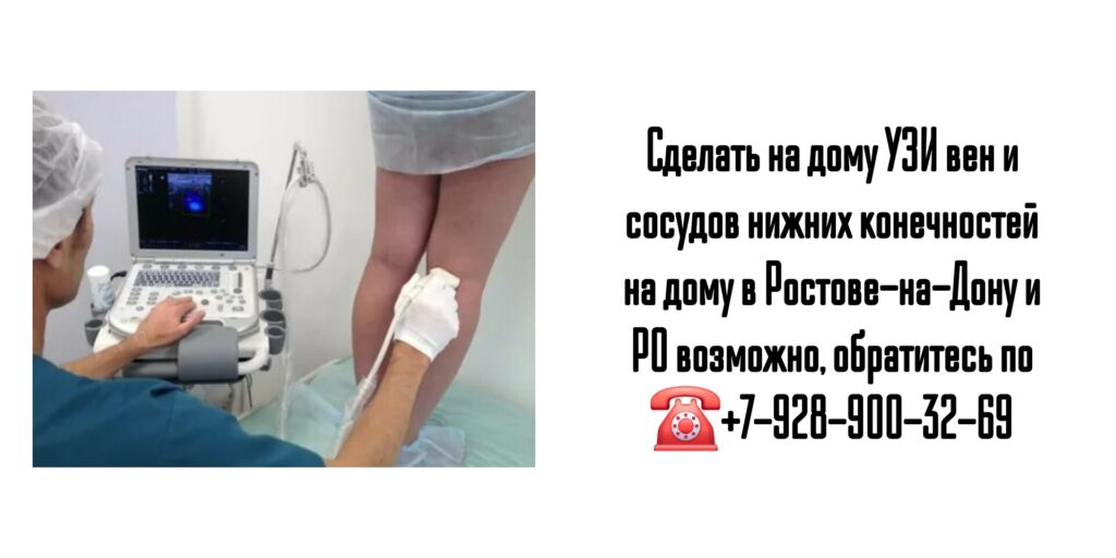 УЗИ вен и сосудов нижних конечностей на дому в Ростове-на-Дону и РО