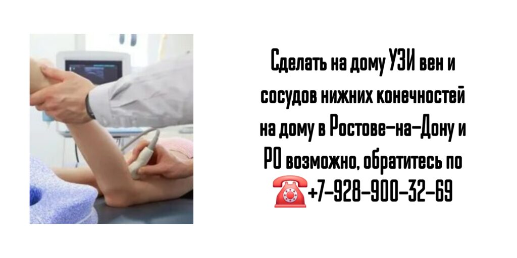 УЗИ вен и сосудов нижних конечностей на дому в Ростове-на-Дону и РО
