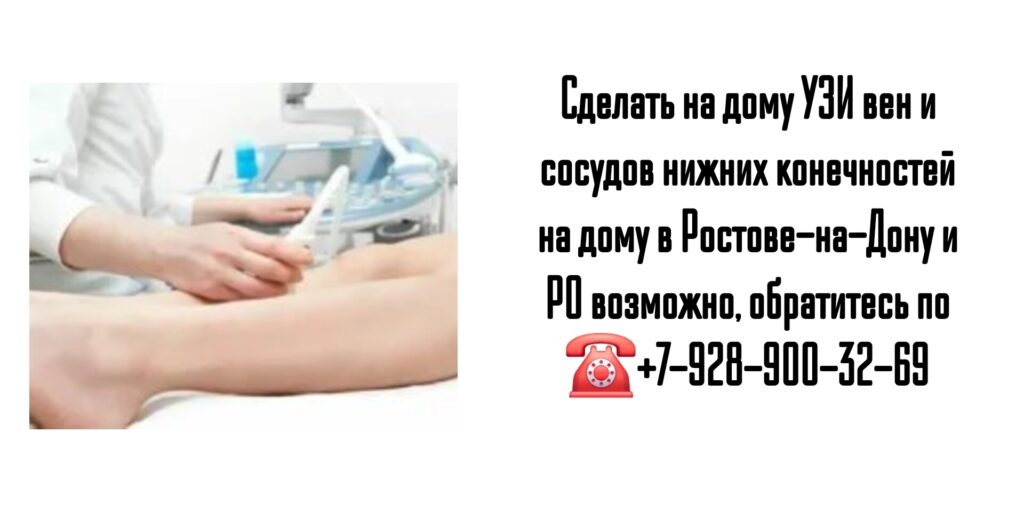УЗИ вен и сосудов нижних конечностей на дому в Ростове-на-Дону и РО