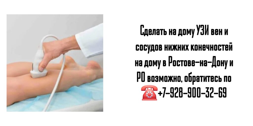 УЗИ вен и сосудов нижних конечностей на дому в Ростове-на-Дону и РО