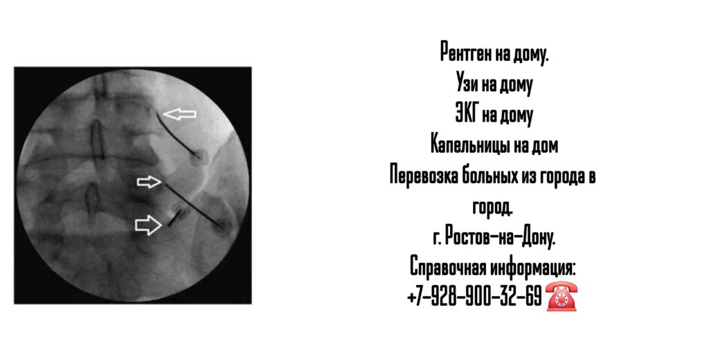 Ростов Рентген на дом - вызов врача