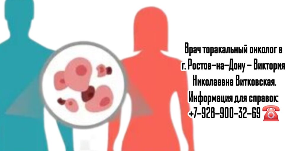 Витковская Виктория Николаевна - торакальный онколог Ростов