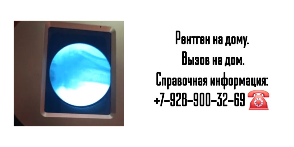 Вызов врача на дом - рентген на дому Ростов-на-Дону