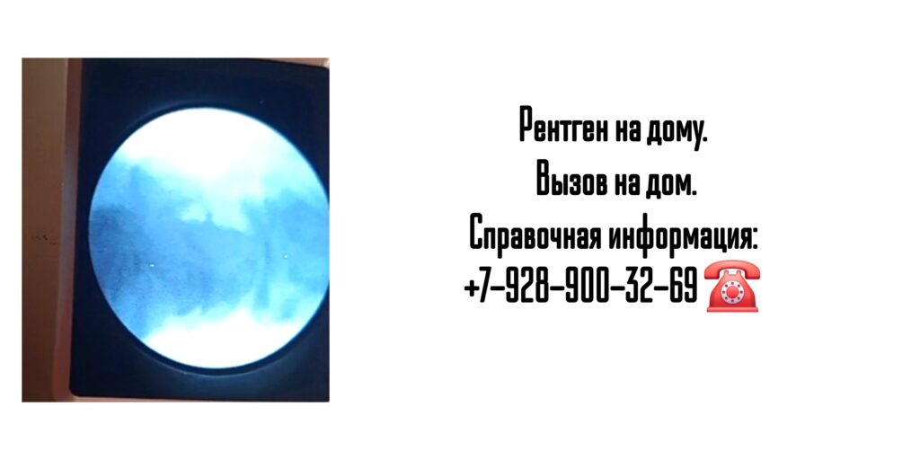 Вызов врача на дом - рентген на дому Ростов-на-Дону