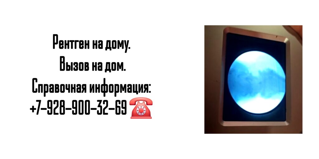 Вызов врача на дом - рентген на дому Ростов-на-Дону