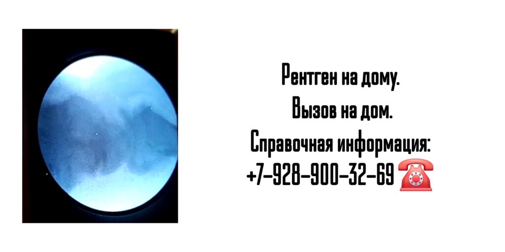 Вызов врача на дом - рентген на дому Ростов-на-Дону