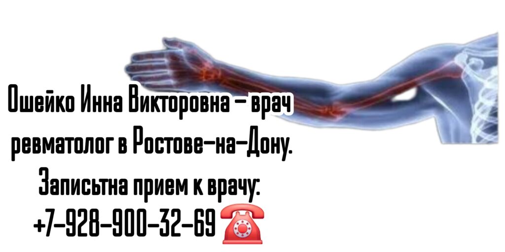 Грамотный ревматолог в Ростове-на-Дону - Ошейко Инна Викторовна