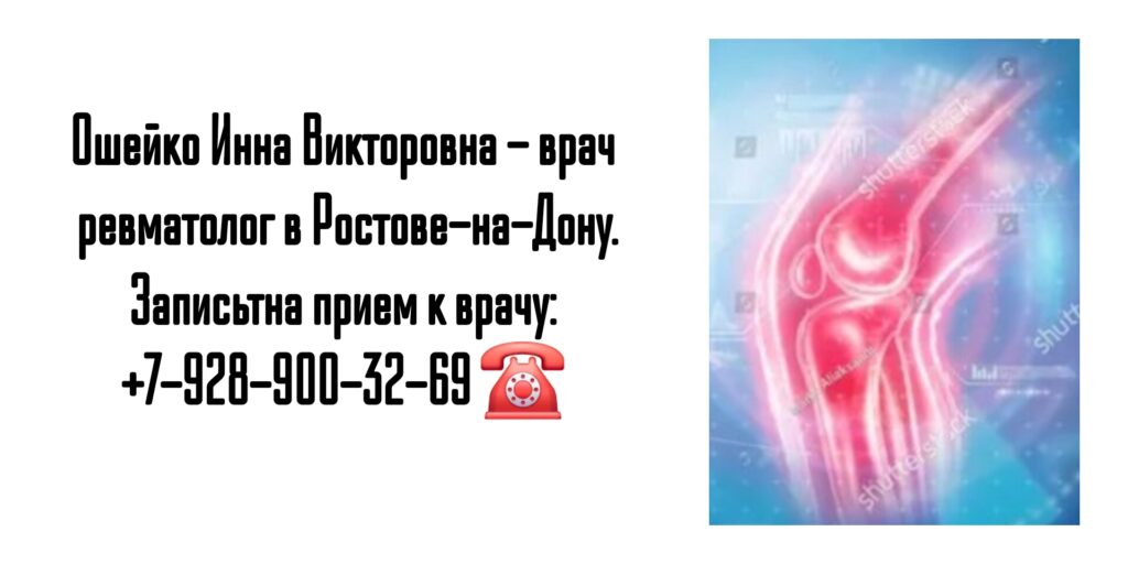 Грамотный ревматолог в Ростове-на-Дону - Ошейко Инна Викторовна