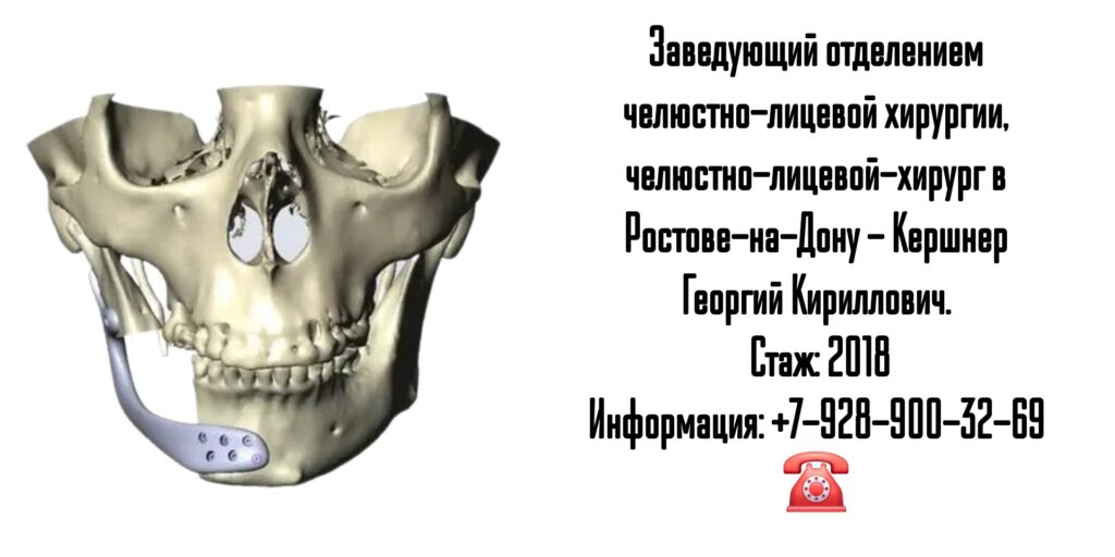 Кершнер Георгий Кириллович - челюстно-лицевой хирург в Ростове-на-Дону 