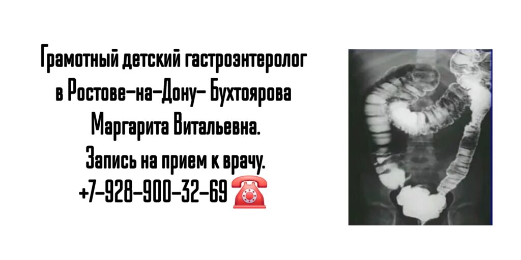 Консультация детского гастроэнтеролога в Ростове-на-Дону- болезнь Крона