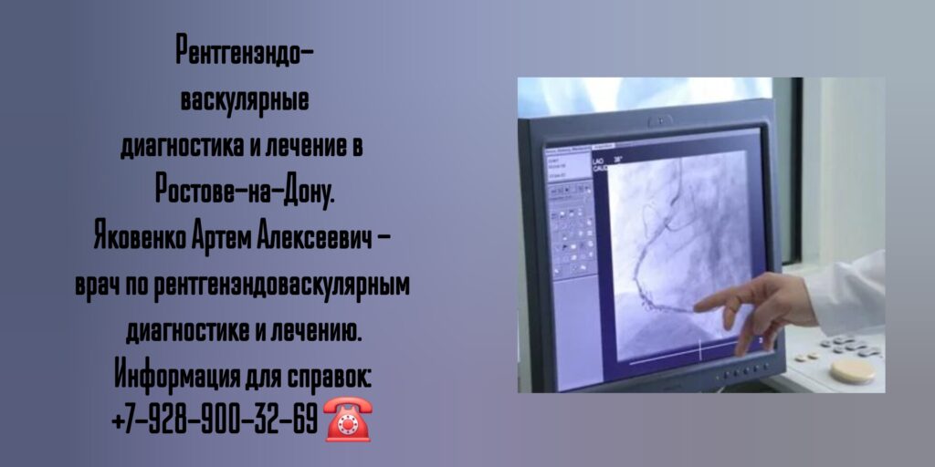 Яковенко Артем Алексеевич - врач по рентгенэндоваскулярным диагностике и лечению в Ростове-на-Дону