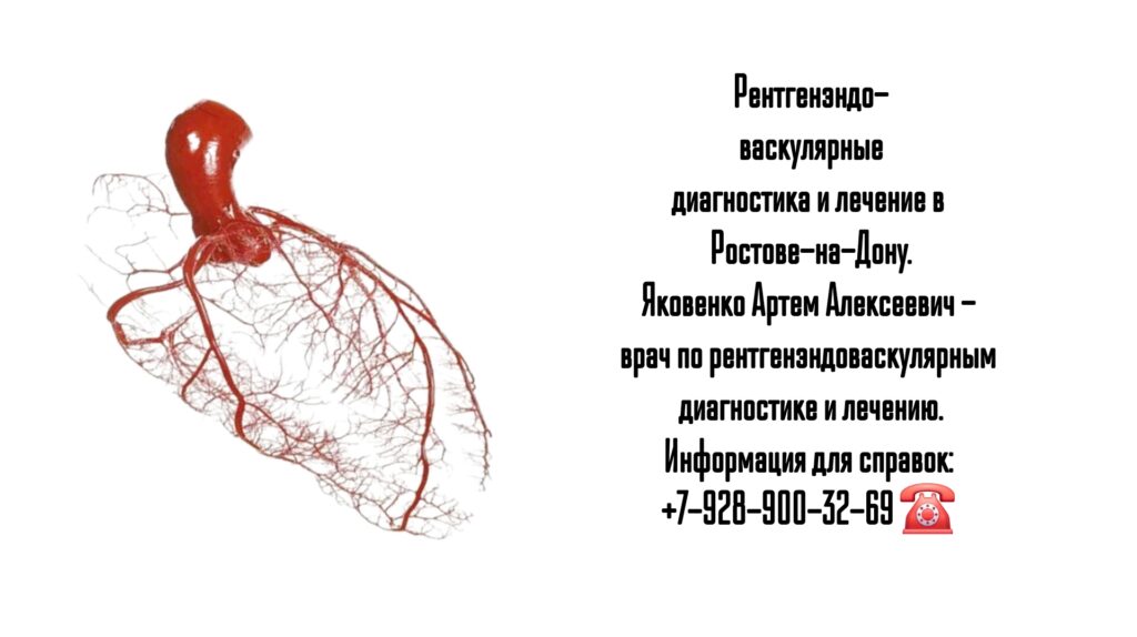Яковенко Артем Алексеевич - врач по рентгенэндоваскулярным диагностике и лечению в Ростове-на-Дону